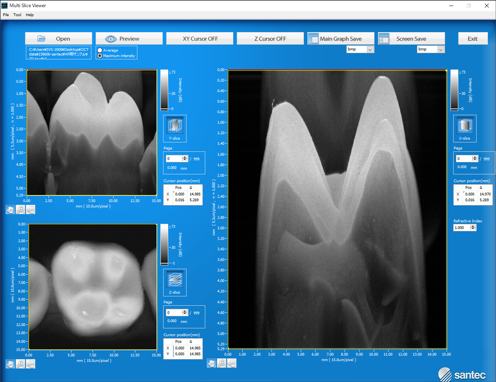 Live Software Oct 3D OCT Image Analysis Software